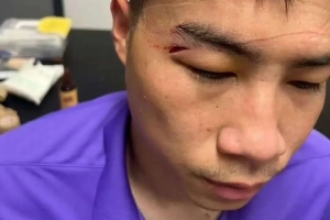 津媒：王獻(xiàn)鈞兩顆門牙被撞斷，楊帆眉骨受傷賽后去醫(yī)院縫針