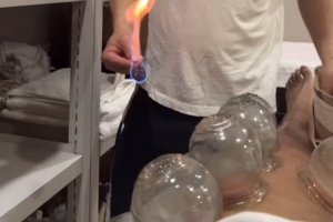 嘗試東方神秘力量！北京男籃外援斯佩爾曼曬拔火罐視頻