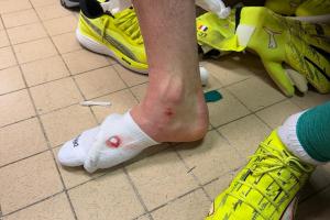 舍瓦利耶談被踢傷：有時(shí)候有些動(dòng)作必須避免，今天我算是非常幸運(yùn)