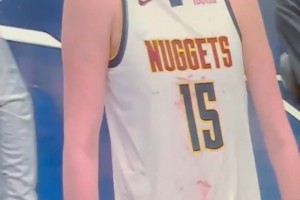 是誰(shuí)干的??今日賽中鏡頭給到約老師，球衣上竟然全是血跡……