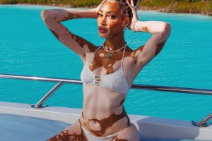 求婚成功后，庫(kù)茲馬與自己的白癜風(fēng)超模未婚妻出海度假??